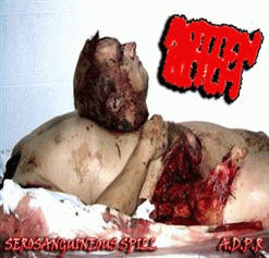 Rotten Bitch : Serosanguineous Spill